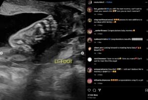 Anthony Edwards' Baby Mama's Reaction To Reported Lack Of Custody Or Visitation Anthony Edwards' Baby Mama's Reaction To Reported Lack Of Custody Or Visitation