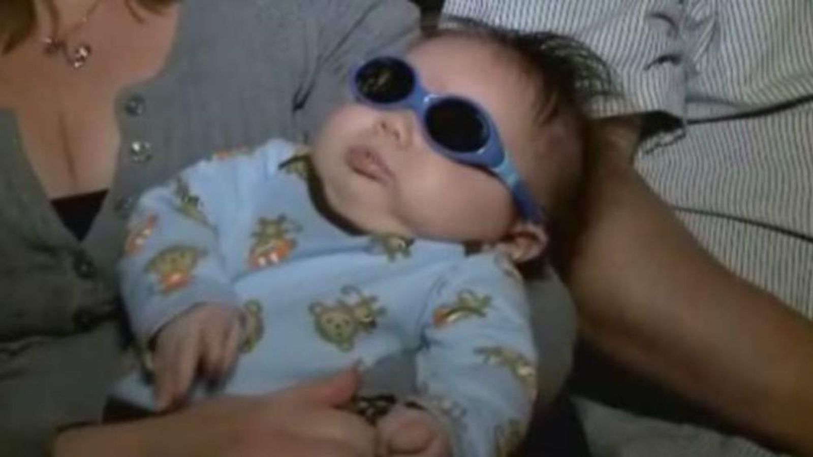 Baby Born Without Eyes: Living With Bilateral Anophthalmia Baby Born Without Eyes: Living With Bilateral Anophthalmia