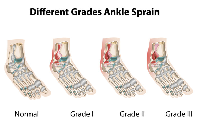 Brunson Expected Back Sunday: Ankle Sprain Recovery Complete Brunson Expected Back Sunday: Ankle Sprain Recovery Complete