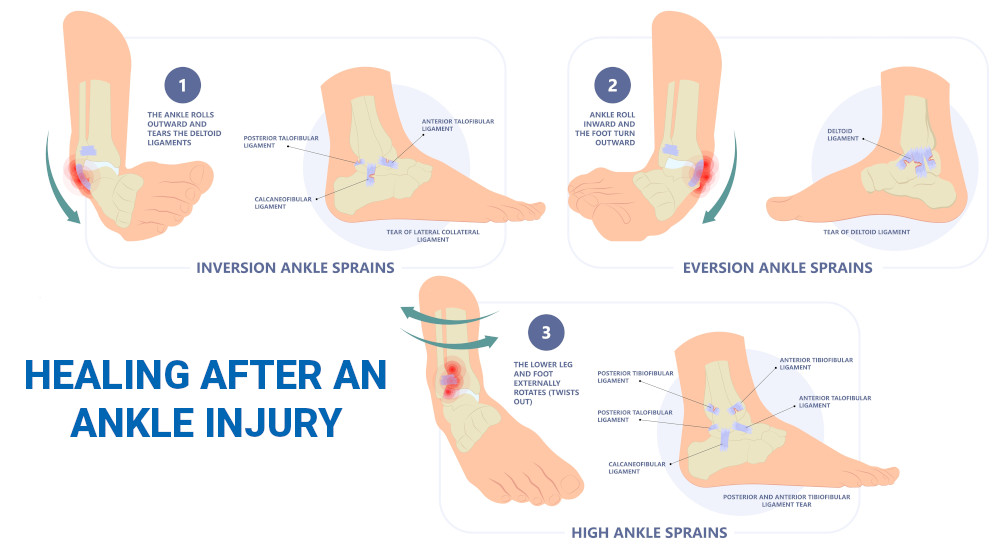 Brunson Expected Back Sunday: One Month After Ankle Sprain Brunson Expected Back Sunday: One Month After Ankle Sprain