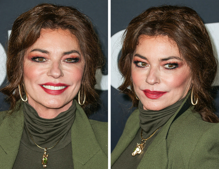 Celebrity Facelift Controversy: Fans React To Altered Appearance Celebrity Facelift Controversy: Fans React To Altered Appearance