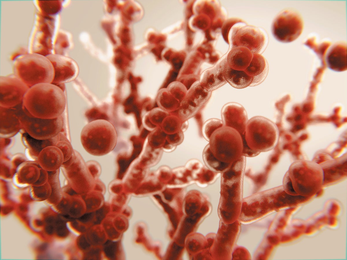 Deadly Fungi: The Emerging Superbug Crisis Deadly Fungi: The Emerging Superbug Crisis