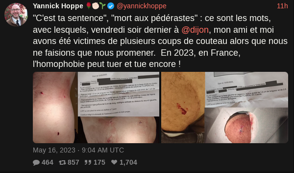 Dijon: Violente Agression Au Lac Kir - Trois Hommes Blessés Dijon: Violente Agression Au Lac Kir - Trois Hommes Blessés