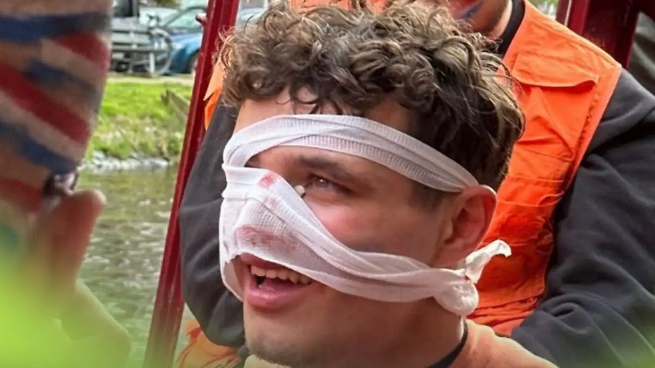 F1 Driver Lando Norris Suffers Unusual Injury Following Party F1 Driver Lando Norris Suffers Unusual Injury Following Party
