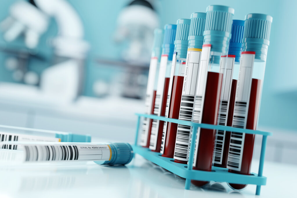 Guilty Plea: Lab Owner Admits To Fraudulent COVID-19 Testing Guilty Plea: Lab Owner Admits To Fraudulent COVID-19 Testing