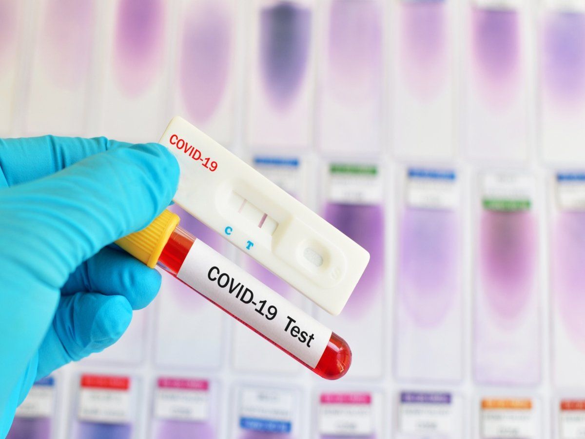 Lab Owner Admits To Falsifying COVID-19 Test Results Lab Owner Admits To Falsifying COVID-19 Test Results