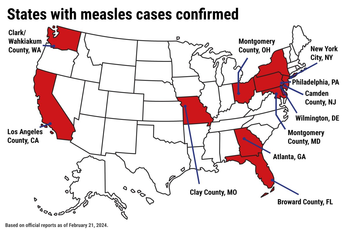 Measles Outbreak In The U.S.: Tracking The Spread And Affected Areas Measles Outbreak In The U.S.: Tracking The Spread And Affected Areas