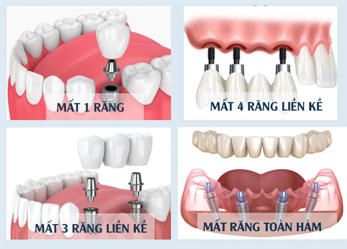 Nghi Vấn Lừa Đảo: Những Điều Cần Biết Trước Khi Đầu Tư Góp Vốn Vào Công Ty