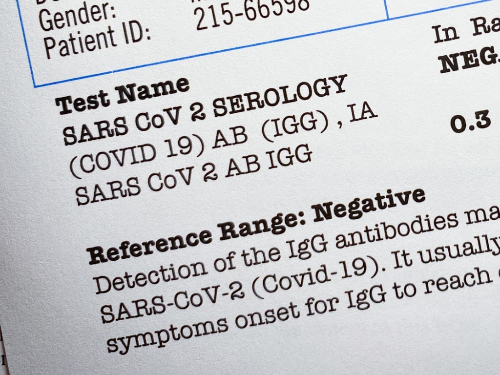 Pandemic Fraud: Lab Owner Convicted For Falsified COVID Test Results Pandemic Fraud: Lab Owner Convicted For Falsified COVID Test Results