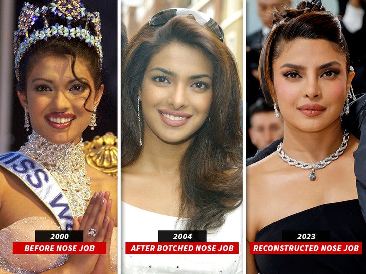 Priyanka Chopra And Her Father: The Truth About Her Nose Surgery Priyanka Chopra And Her Father: The Truth About Her Nose Surgery