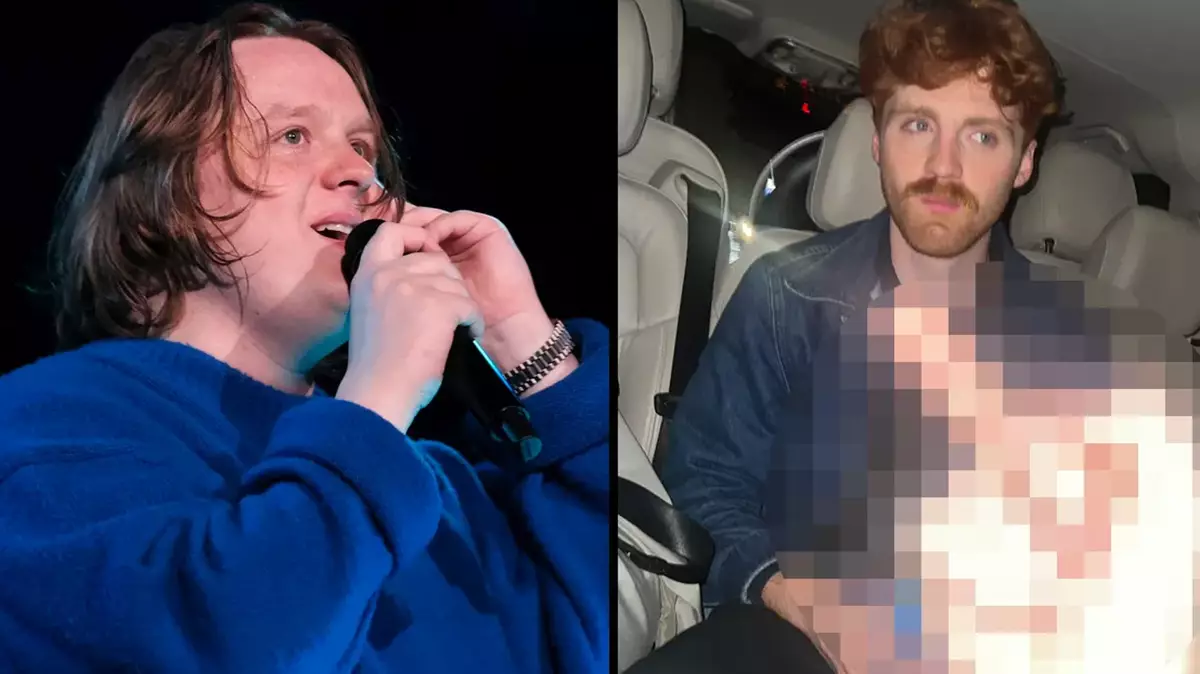 Singer Lewis Capaldi Makes Rare Public Appearance, Offers Thumbs Up Singer Lewis Capaldi Makes Rare Public Appearance, Offers Thumbs Up
