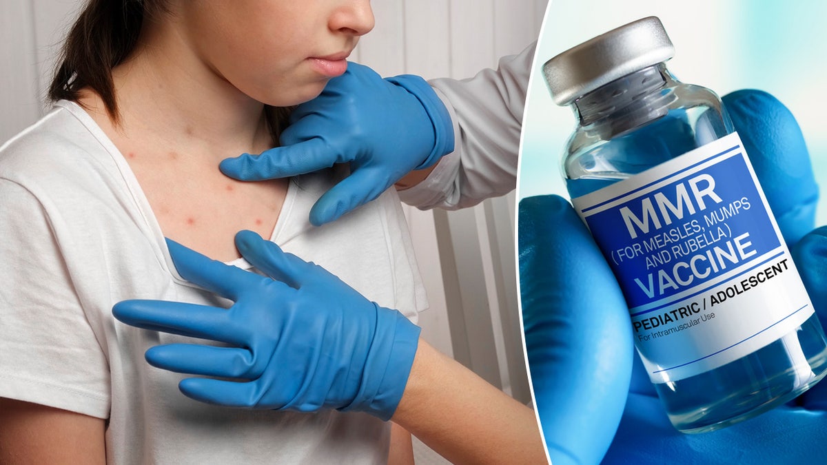 Strengthening Vaccine Oversight In The US: A Response To The Measles Epidemic Strengthening Vaccine Oversight In The US: A Response To The Measles Epidemic