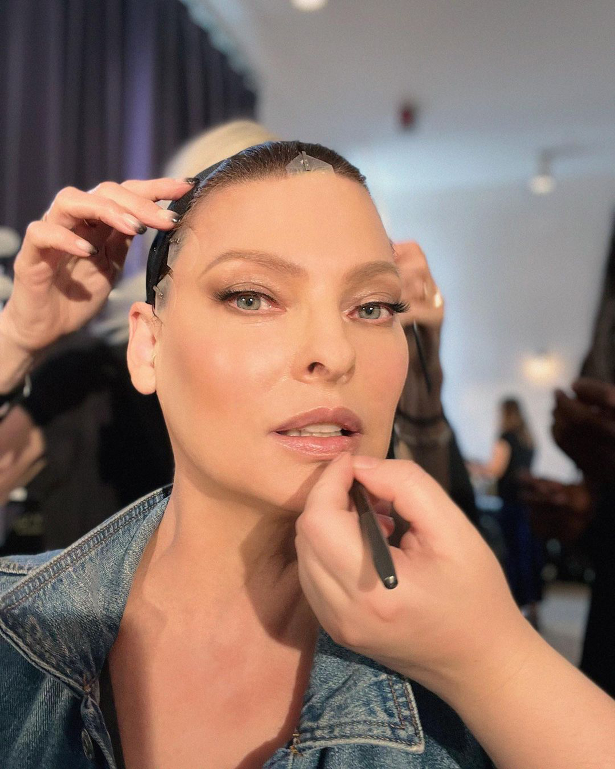 The Psychological Toll Of CoolSculpting: Lessons From Linda Evangelista's Experience