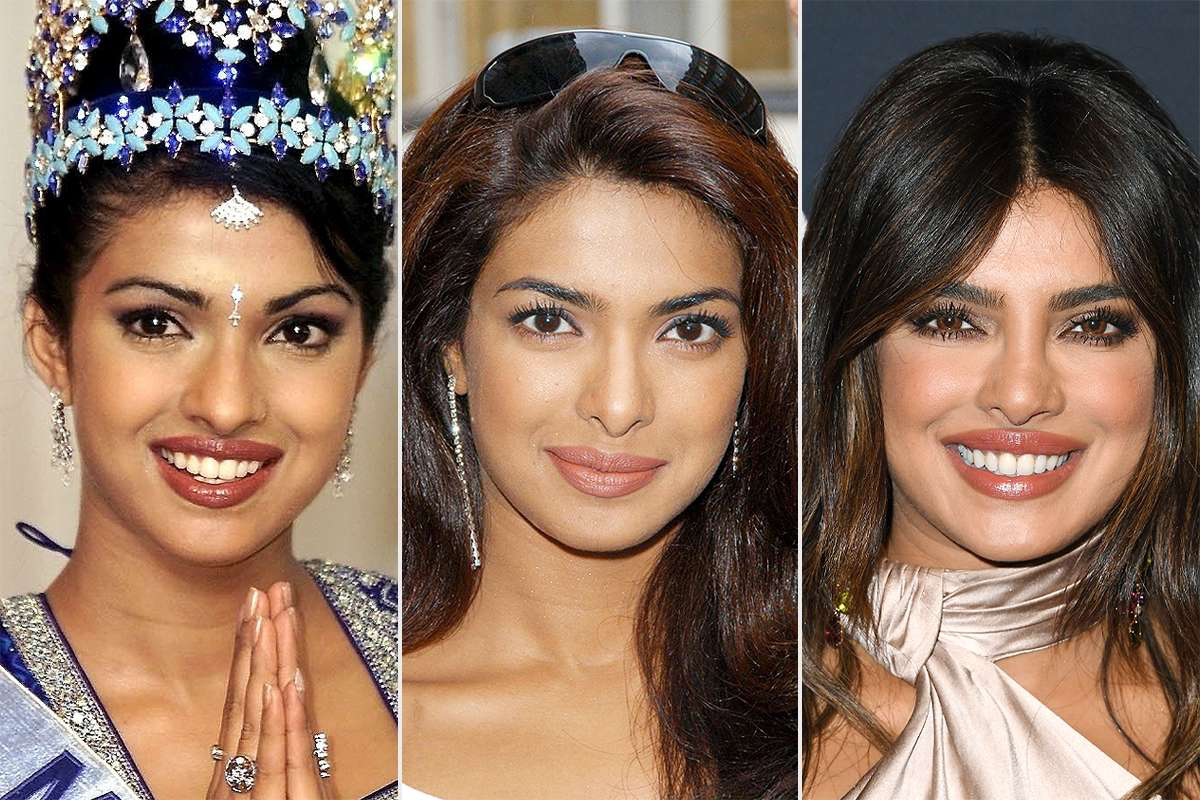The Untold Story: Priyanka Chopra, Her Nose, And Her Father's Reaction The Untold Story: Priyanka Chopra, Her Nose, And Her Father's Reaction
